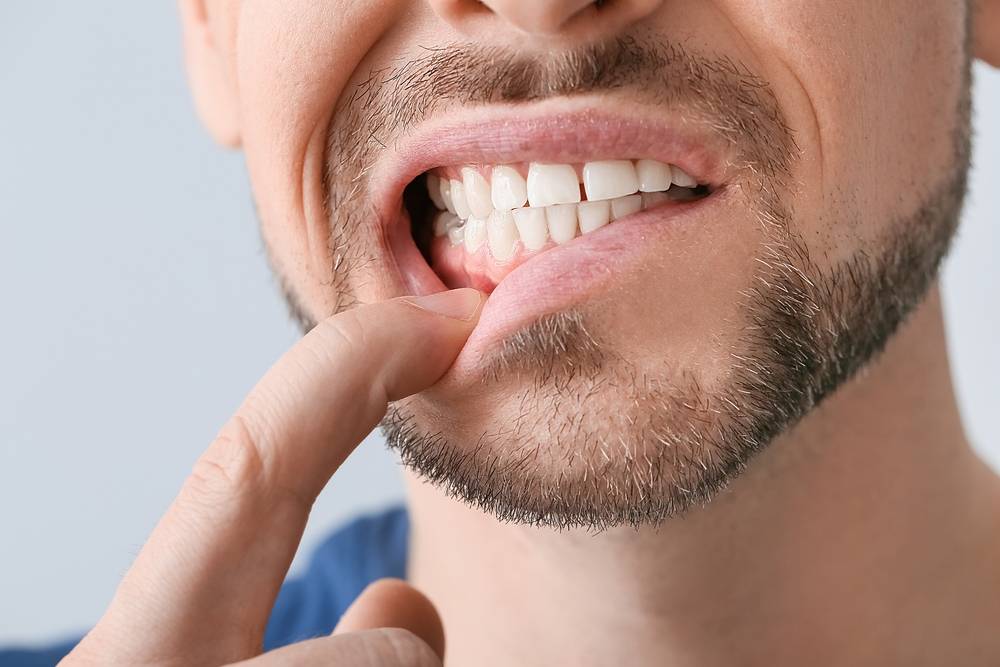 fix grinded teeth Exeter ON