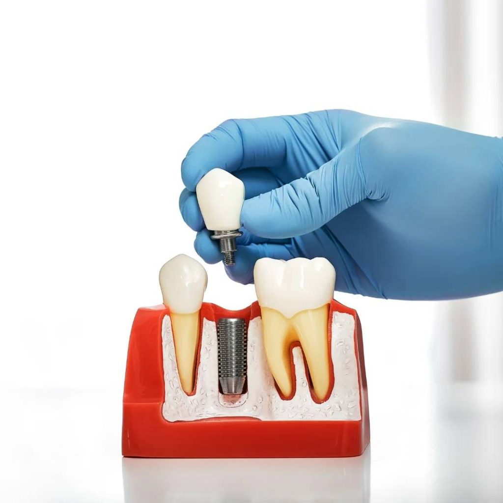 pain meds after wisdom teeth Exeter, ON
